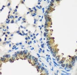 Immunohistochemistry CYP2F1 Antibody - BSA Free