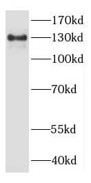 Western Blot CYFIP2 Antibody - BSA Free
