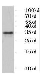 Western Blot: Cyclin G Antibody - BSA Free [NBP3-48072] - Jurkat cells were subjected to SDS PAGE followed by western blot with (Cyclin G antibody) at dilution of 1:1000