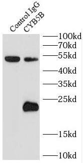 Immunoprecipitation: Cytochrome b5 Outer Mitochondrial Membrane Antibody - BSA Free [NBP3-48074] - IP Result of anti-Cytochrome b5 Outer Mitochondrial Membrane (IP:, 3ug; Detection: 1:500) with mouse lung tissue lysate 4000ug.