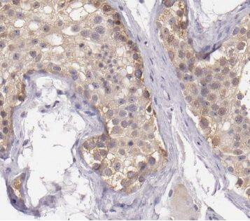 Immunohistochemistry Cytochrome b5 Outer Mitochondrial Membrane Antibody - BSA Free