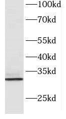 Western Blot CXorf56/MRX107 Antibody - BSA Free