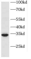 Western Blot: PBDC1 Antibody - BSA Free [NBP3-48078] - A549 cells were subjected to SDS PAGE followed by western blot with (PBDC1 Antibody) at dilution of 1:300