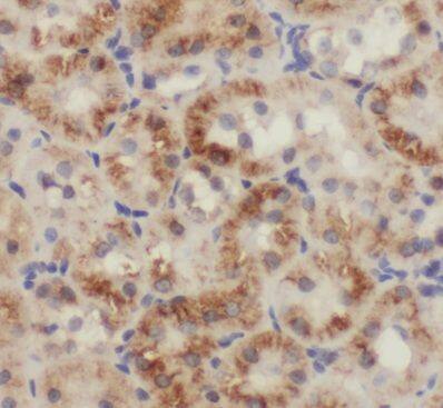Immunohistochemistry: PBDC1 Antibody - BSA Free [NBP3-48078] - Immunohistochemistry of paraffin-embedded human kidney tissue slide using (PBDC1 Antibody) at dilution of 1:50