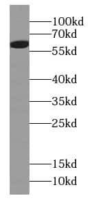 Western Blot: taxilin gamma Antibody - BSA Free [NBP3-48079] - Mouse kidney tissue were subjected to SDS PAGE followed by western blot with ( taxilin gamma Antibody) at dilution of 1:1000
