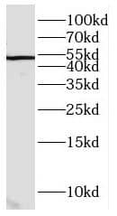 Western Blot: CCDC49 Antibody - BSA Free [NBP3-48081] - HeLa cells were subjected to SDS PAGE followed by western blot with (CCDC49 Antibody) at dilution of 1:1000