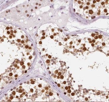 Immunohistochemistry: CCDC49 Antibody - BSA Free [NBP3-48081] - Immunohistochemistry of paraffin-embedded human testis tissue slide using (CCDC49 Antibody) at dilution of 1:50