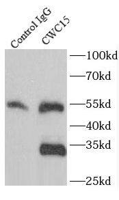 Immunoprecipitation: CWC15 Antibody - BSA Free [NBP3-48082] - IP Result of anti-CWC15 (IP:, 3ug; Detection: 1:600) with HeLa cells lysate 2800ug.
