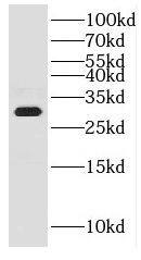 Western Blot CWC15 Antibody - BSA Free