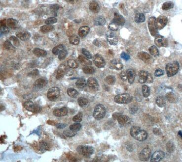 Immunohistochemistry: CWC15 Antibody - BSA Free [NBP3-48082] - Immunohistochemistry of paraffin-embedded human stomach tissue slide using (CWC15 Antibody) at dilution of 1:50