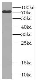Western Blot: CTTNBP2NL Antibody - BSA Free [NBP3-48086] - MCF-7 cells were subjected to SDS PAGE followed by western blot with ( CTTNBP2NL Antibody) at dilution of 1:1000