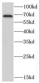Western Blot CTDSPL2 Antibody - BSA Free