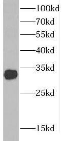 Western Blot CTDSP1 Antibody - BSA Free