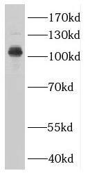 Western Blot: CTAGE5 Antibody - BSA Free [NBP3-48091] - Human testis tissue were subjected to SDS PAGE followed by western blot with (CTAGE5 antibody) at dilution of 1:300