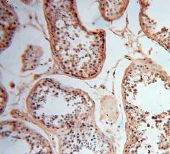 Immunohistochemistry: CSNK1A1L Antibody - BSA Free [NBP3-48097] - Immunohistochemistry of paraffin-embedded human testis using (CSNK1A1L antibody) at dilution of 1:100