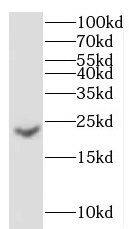 Western Blot: gamma C Crystallin Antibody - BSA Free [NBP3-48103] - Human brain tissue were subjected to SDS PAGE followed by western blot with (gamma C Crystallin antibody) at dilution of 1:500