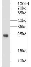 Western Blot CRYBB3 Antibody - BSA Free