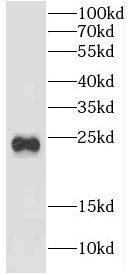 Western Blot: CRYBB2 Antibody - BSA Free [NBP3-48105] - Mouse brain tissue were subjected to SDS PAGE followed by western blot with ( CRYBB2 Antibody) at dilution of 1:300