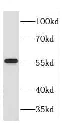 Western Blot: CROP Antibody - BSA Free [NBP3-48107] - Jurkat cells were subjected to SDS PAGE followed by western blot with (CROP antibody) at dilution of 1:600