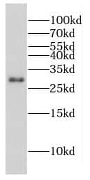 Western Blot: CPXCR1 Antibody - BSA Free [NBP3-48113] - Mouse liver tissue were subjected to SDS PAGE followed by western blot with ( CPXCR1 Antibody) at dilution of 1:300