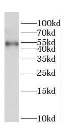 Western Blot: pre-mRNA cleavage factor I (59 kDa subunit) Antibody - BSA Free [NBP3-48115] - Mouse brain tissue were subjected to SDS PAGE followed by western blot with (pre-mRNA cleavage factor I (59 kDa subunit) antibody) at dilution of 1:500