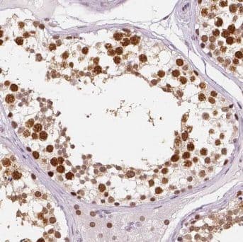 Immunohistochemistry: pre-mRNA cleavage factor I (59 kDa subunit) Antibody - BSA Free [NBP3-48115] - Immunohistochemistry of paraffin-embedded human testis using (pre-mRNA cleavage factor I (59 kDa subunit) antibody) at dilution of 1:50