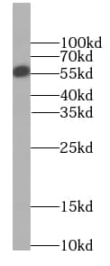 Western Blot: CPNE9 Antibody - BSA Free [NBP3-48118] - Mouse brain tissue were subjected to SDS PAGE followed by western blot with (CPNE9 antibody) at dilution of 1:200