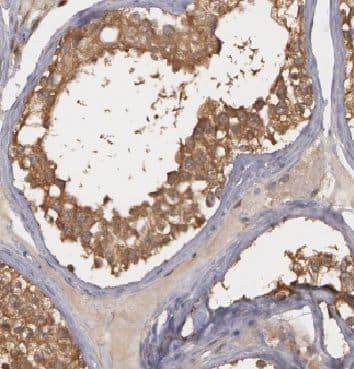 Immunohistochemistry ADPRHL2 Antibody - BSA Free