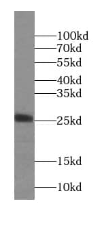 Western Blot NAA11 Antibody - BSA Free