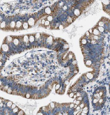 Immunohistochemistry: ARAP3 Antibody - BSA Free [NBP3-48122] - Immunohistochemistry of paraffin-embedded human colon tissue slide using (ARAP3 Antibody) at dilution of 1:50