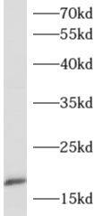Western Blot: Apolipoprotein C4 Antibody - BSA Free [NBP3-48124] - Human plasma tissue were subjected to SDS PAGE followed by western blot with ( Apolipoprotein C4 Antibody) at dilution of 1:300