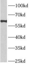 Western Blot: APLF Antibody - BSA Free [NBP3-48126] - PC-3 cells were subjected to SDS PAGE followed by western blot with (APLF antibody) at dilution of 1:600