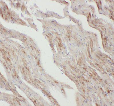 Immunohistochemistry: Apelin Antibody - BSA Free [NBP3-48129] - Immunohistochemistry of paraffin-embedded mouse heart tissue using (anti- Apelin antibody) at dilution of 1:200