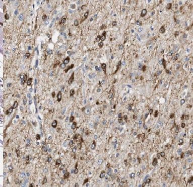 Immunohistochemistry ANAPC2 Antibody - BSA Free