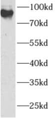 Western Blot: ANAPC2 Antibody - BSA Free [NBP3-48130] - MCF7 cells were subjected to SDS PAGE followed by western blot with (ANAPC2 antibody) at dilution of 1:500