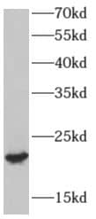 Western Blot: AP3S2 Antibody - BSA Free [NBP3-48132] - Human testis tissue were subjected to SDS PAGE followed by western blot with (AP3S2 antibody) at dilution of 1:800