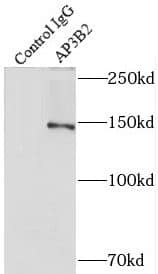 Immunoprecipitation: AP3B2 Antibody - BSA Free [NBP3-48135] - IP Result of anti-AP3B2 (IP:, 4ug; Detection: 1:500) with mouse brain tissue lysate 3600ug.