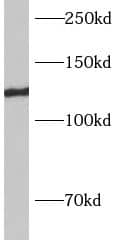 Western Blot: AP3B2 Antibody - BSA Free [NBP3-48135] - Rat brain tissue were subjected to SDS PAGE followed by western blot with (AP3B2 Antibody) at dilution of 1:600