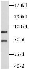Western Blot AP1G2 Antibody - BSA Free