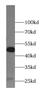 Western Blot Antizyme inhibitor 1 Antibody - BSA Free