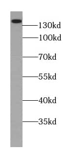 Western Blot ANO8 Antibody - BSA Free