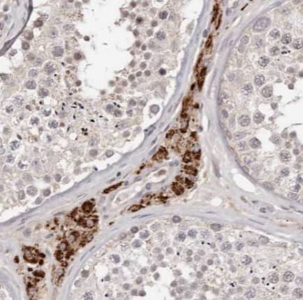 Immunohistochemistry TMEM16K Antibody - BSA Free
