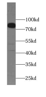 Western Blot TMEM16K Antibody - BSA Free
