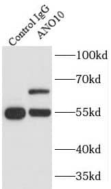 Immunoprecipitation TMEM16K Antibody - BSA Free