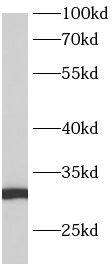 Western Blot: ANKRD7 Antibody - BSA Free [NBP3-48145] - Human testis tissue were subjected to SDS PAGE followed by western blot with (ANKRD7 Antibody) at dilution of 1:300