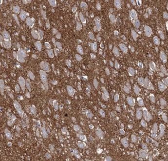Immunohistochemistry: ANKRD57 Antibody - BSA Free [NBP3-48147] - Immunohistochemistry of paraffin-embedded human cerebellum tissue slide using (ANKRD57 Antibody) at dilution of 1:50