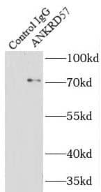 Immunoprecipitation: ANKRD57 Antibody - BSA Free [NBP3-48147] - IP Result of anti-ANKRD57 (IP:, 3ug; Detection: 1:1000) with HeLa cells lysate 3000ug.