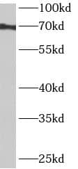 Western Blot: ANKRD55 Antibody - BSA Free [NBP3-48148] - HeLa cells were subjected to SDS PAGE followed by western blot with (ANKRD55 Antibody) at dilution of 1:600