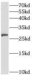 Western Blot: ANKRD49 Antibody - BSA Free [NBP3-48152] - MCF-7 cells were subjected to SDS PAGE followed by western blot with (ANKRD49 Antibody) at dilution of 1:600