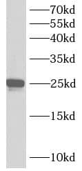 Western Blot: Ankyrin repeat domain 39 Antibody - BSA Free [NBP3-48153] - PC-3 cells were subjected to SDS PAGE followed by western blot with (Ankyrin repeat domain 39 Antibody) at dilution of 1:300